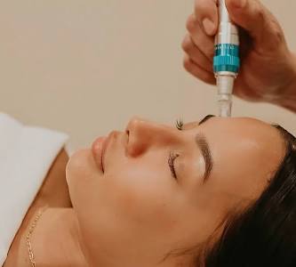 Microneedling Facial