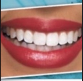 DELUXE 4-6 Shades Whiter
