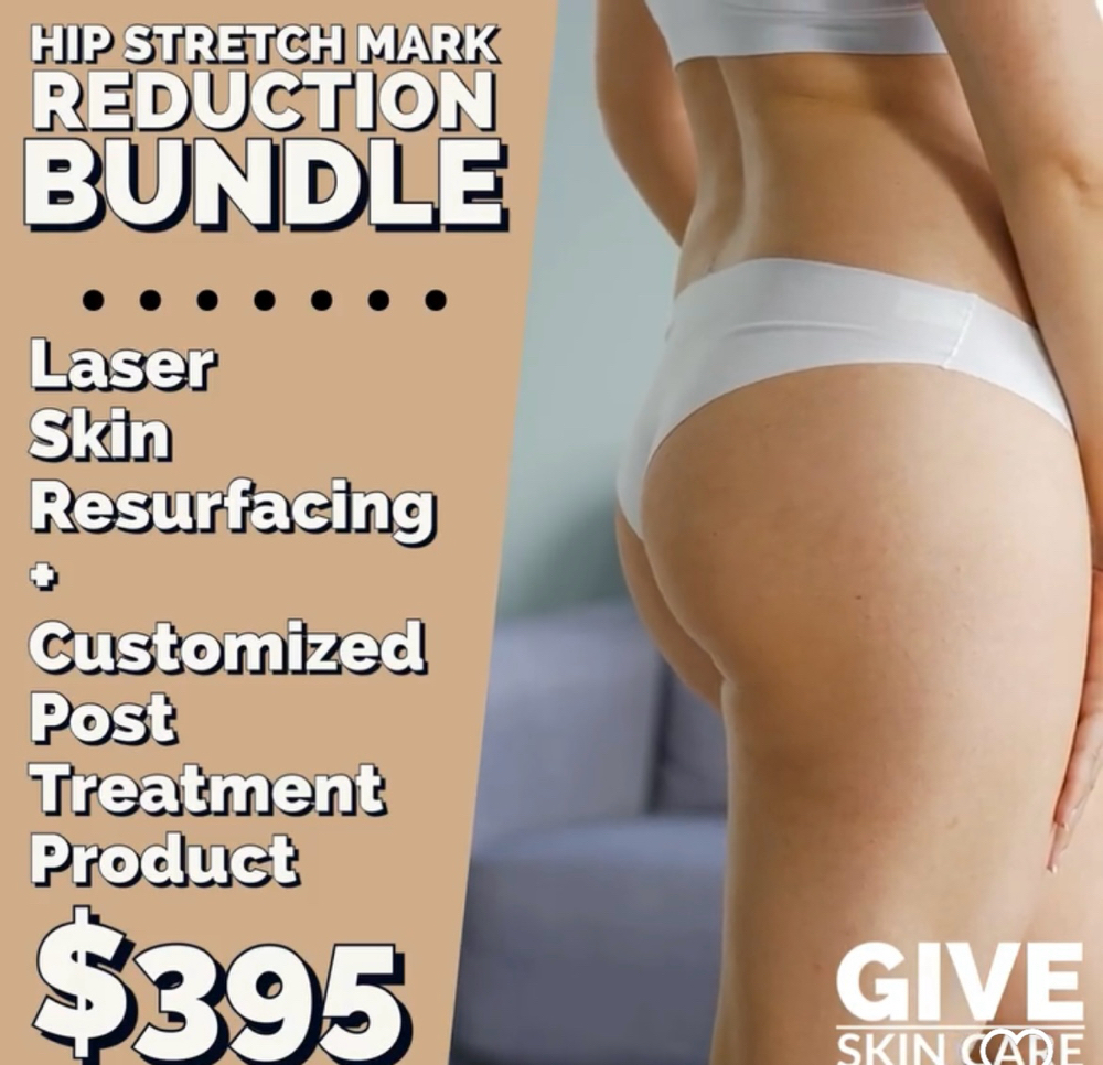 Stretch Mark Reduction Bundle