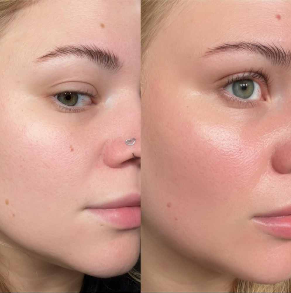 “Just Make Me Glow” Facial at The Full Edit Aesthetic Studio in Florence, AL