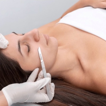 Dermaplane | Add-on at Vice Kingz Esthetics in Murrieta, CA