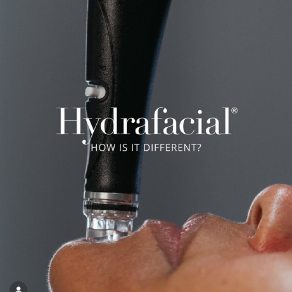 HydraFacial Lip & Eye Perk Add-on at Milagro Beauty Bar in Plymouth, MI