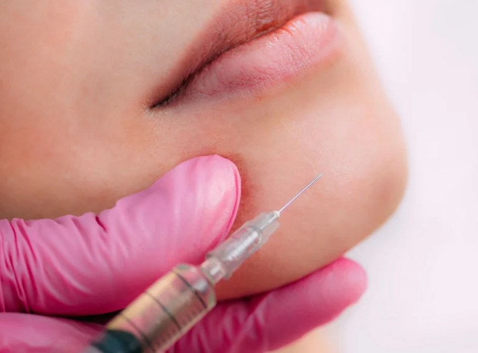 Chin Filler