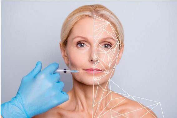 Sculptra- Biostimulation