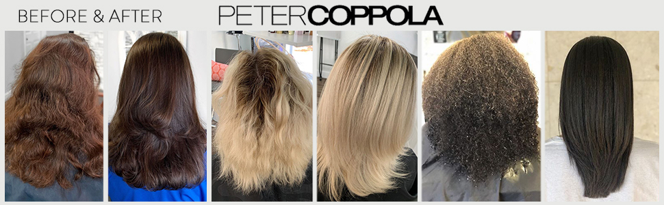 Peter Coppola Kertain Treatments