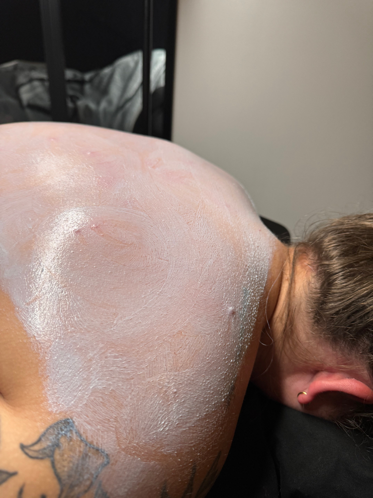 Back Facial at Bare Beauty Esthetics, LLC in Lenoir City, TN