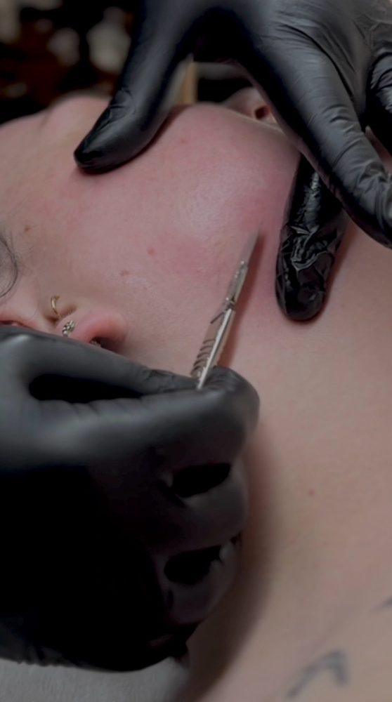 Lamina Nova Dermaplane