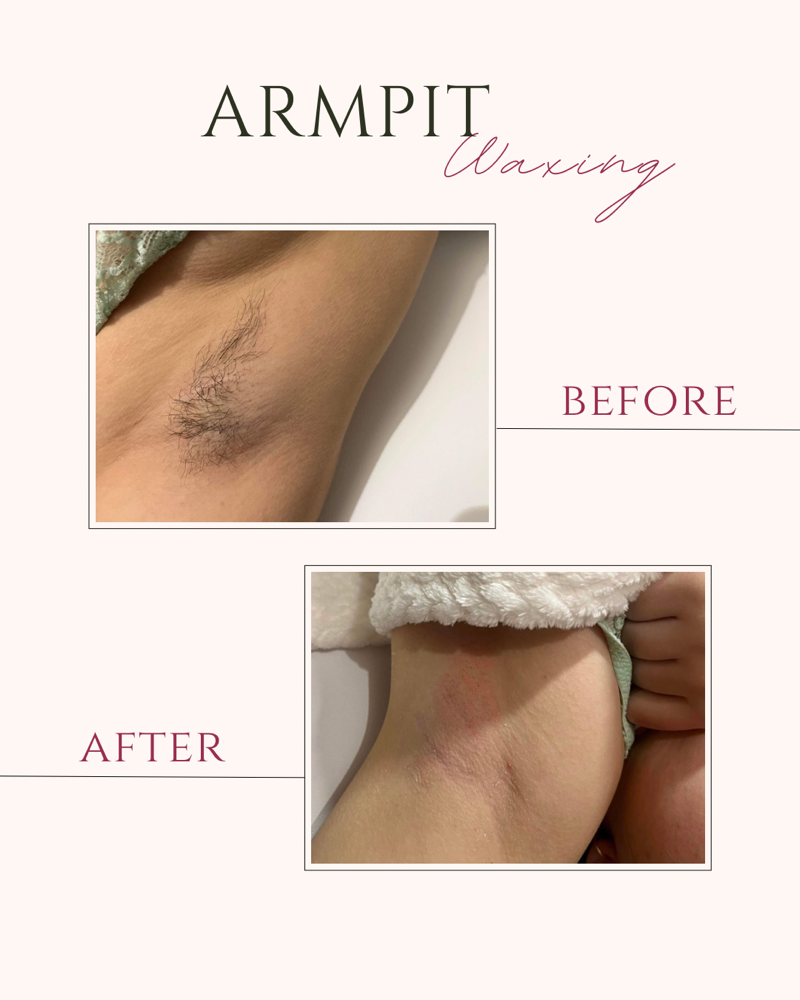 Armpit Waxing