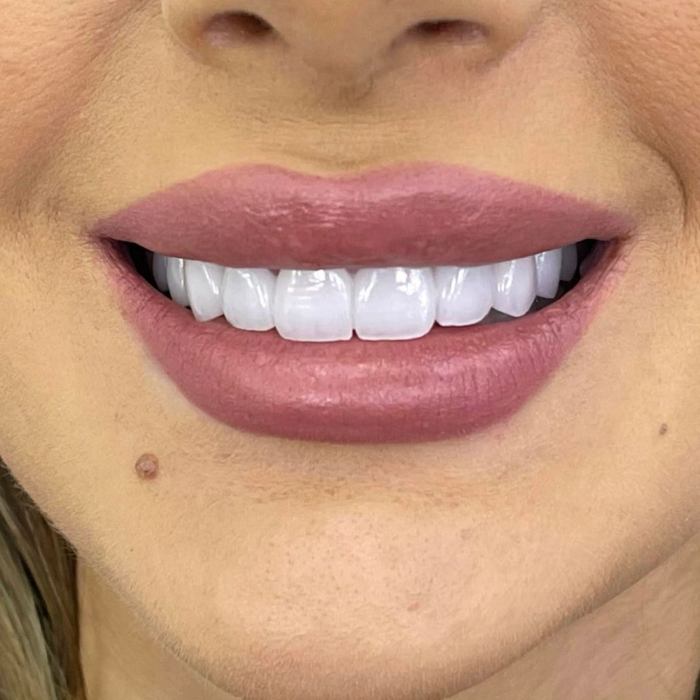 Waxing / Teeth Whitening