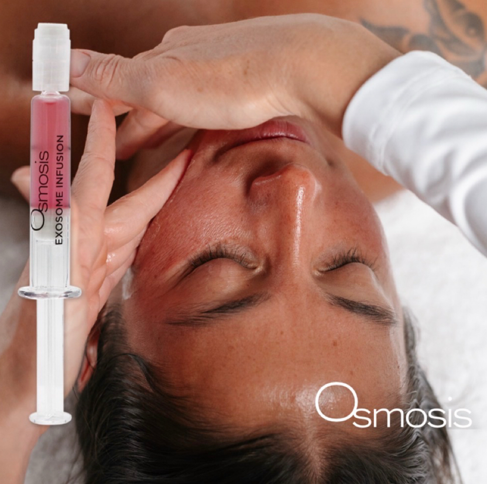 Exosome Hydration Facial at Skintology Apothecary in Tyler, TX