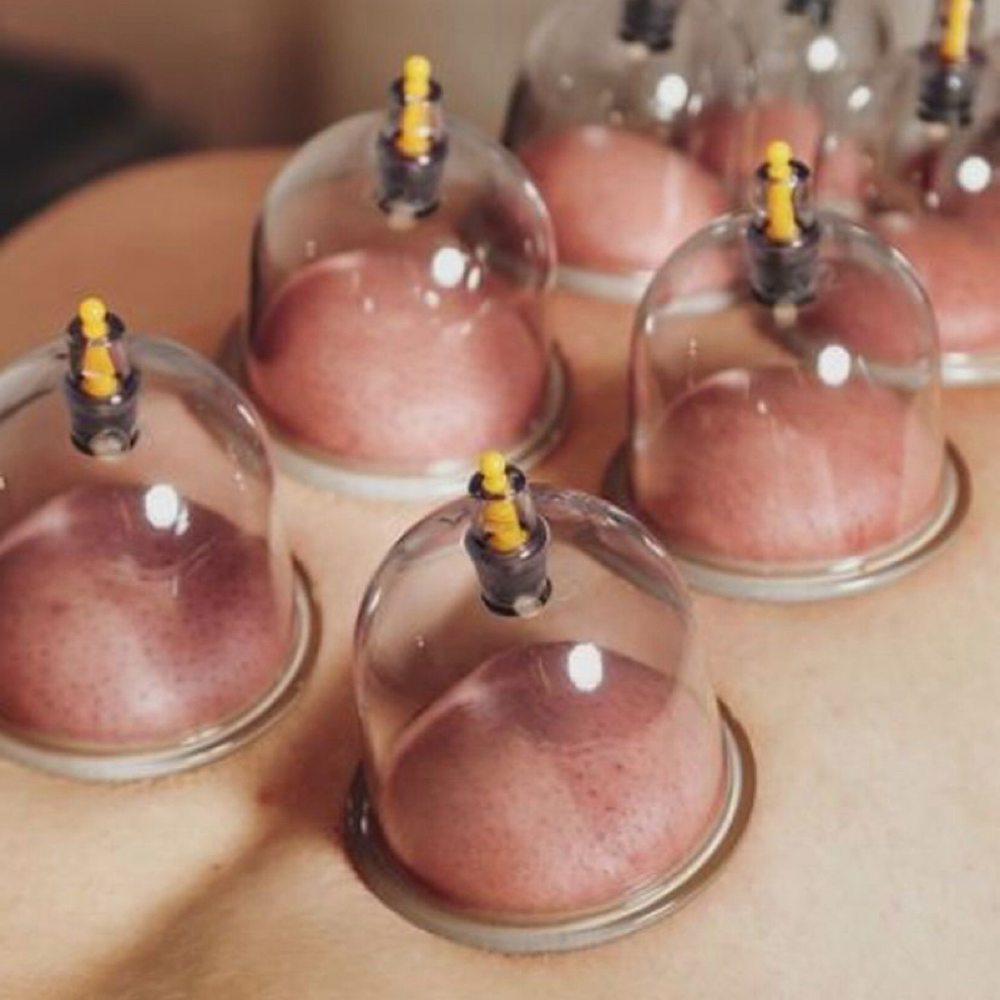 Cupping Therapy | Focused Session
