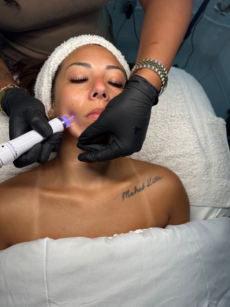 HYDROGLOW FACIAL (Hydrodermabras