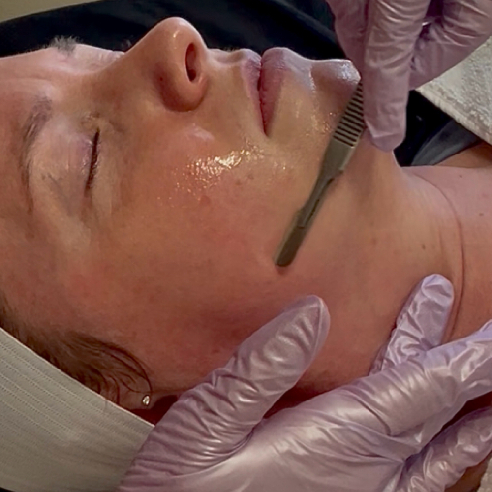 Dermaplane Facial at Esthetics By Ili LLC in Ellensburg, WA