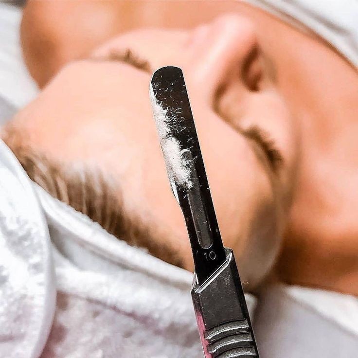 Dermaplaning Treatment