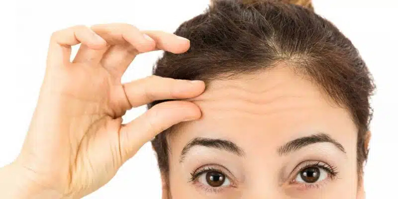 Toxin Dysport/Botox at Amy Donaldson Nurse Injector in Westport, MA