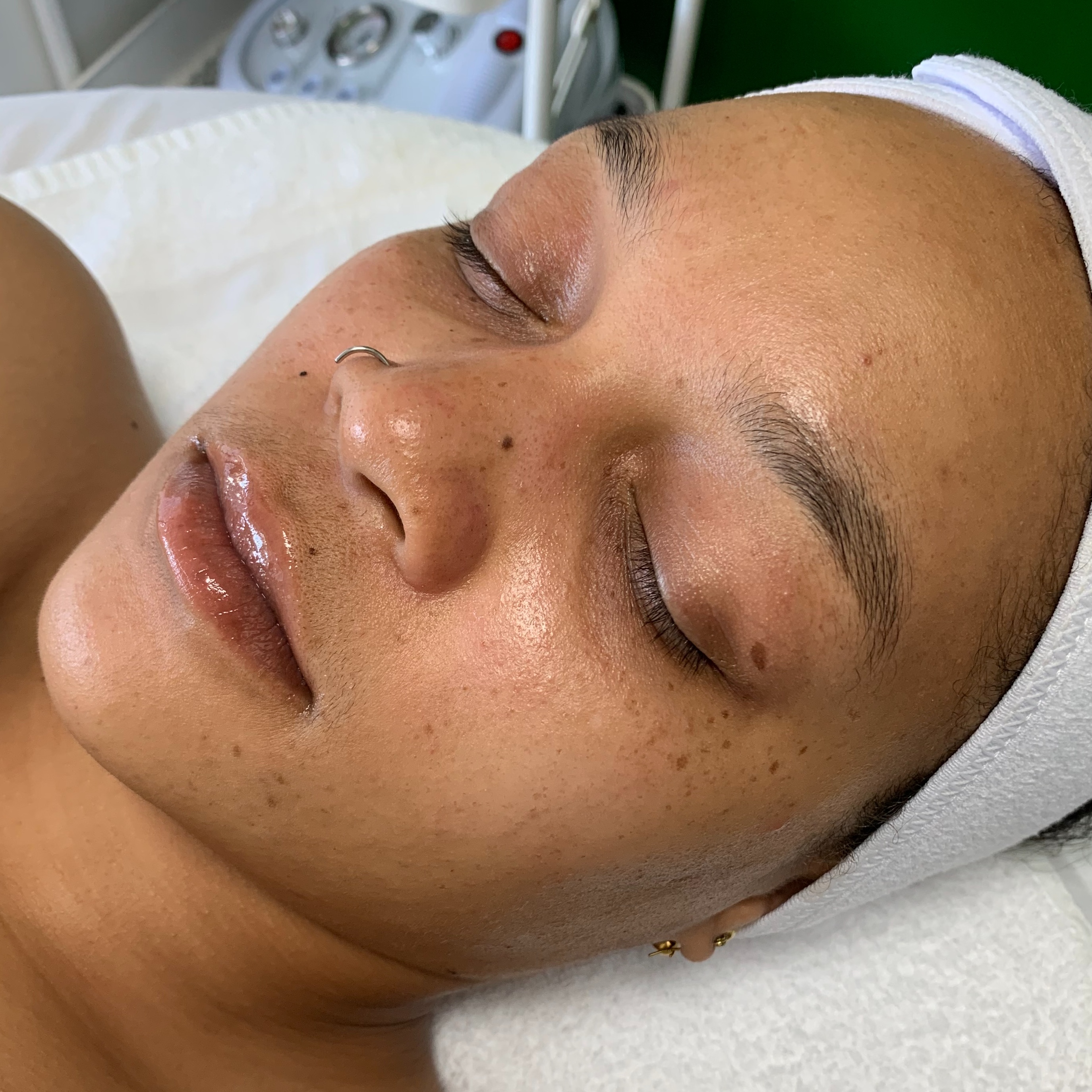 Diamond Dew Facial at Velnaira in Lakewood, CA