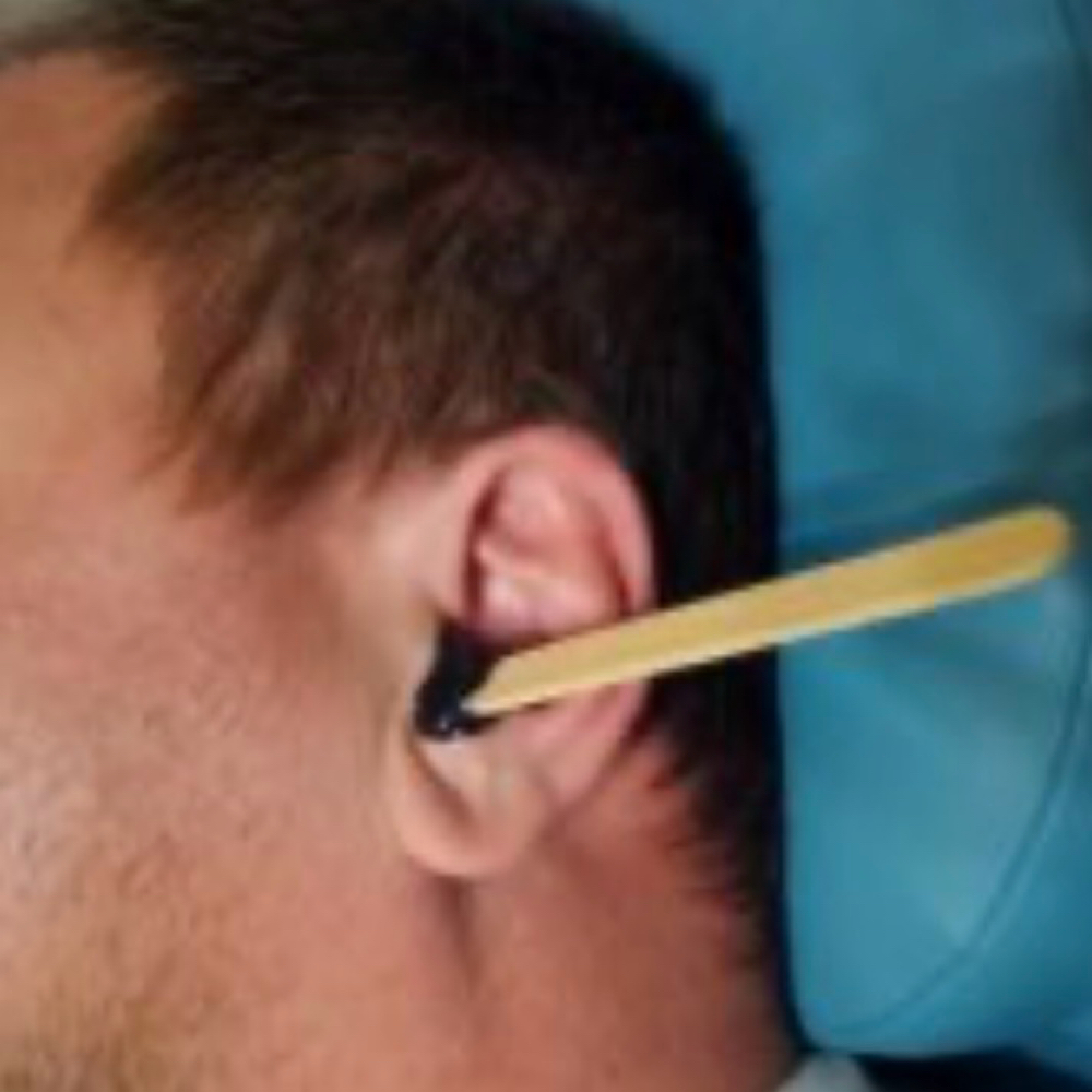 Ear Hair Removal at Velvet Esthetics in Aiea, HI