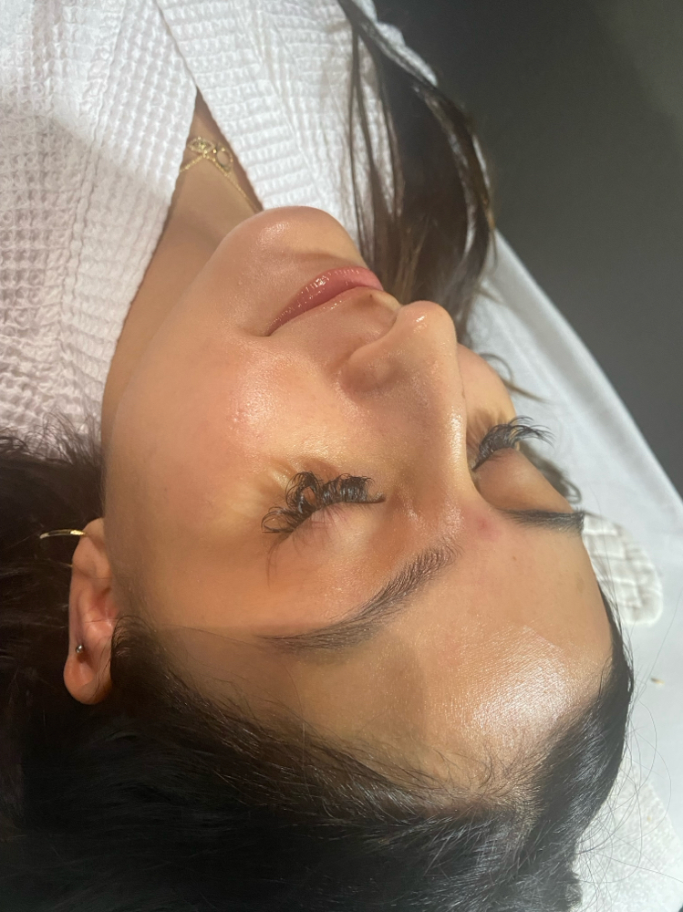 Light Chemical Peel at Babysk.n in Loving, NM