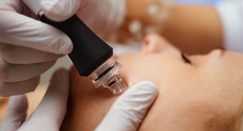 Hydroderm Facial