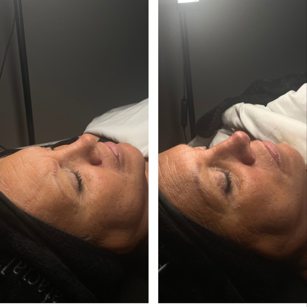 Skin Discovery Facial (New Clients) at Ashlyn Rogers Esthetics in Paducah, KY