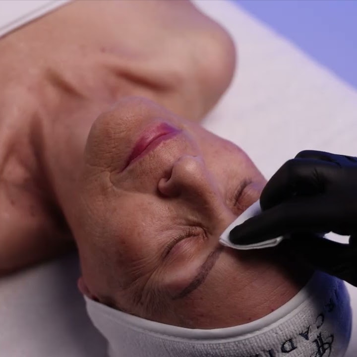 Circadia SWiCH Age Renewal Program at Enhanced Beauty by Madison Taylor in Spring, TX