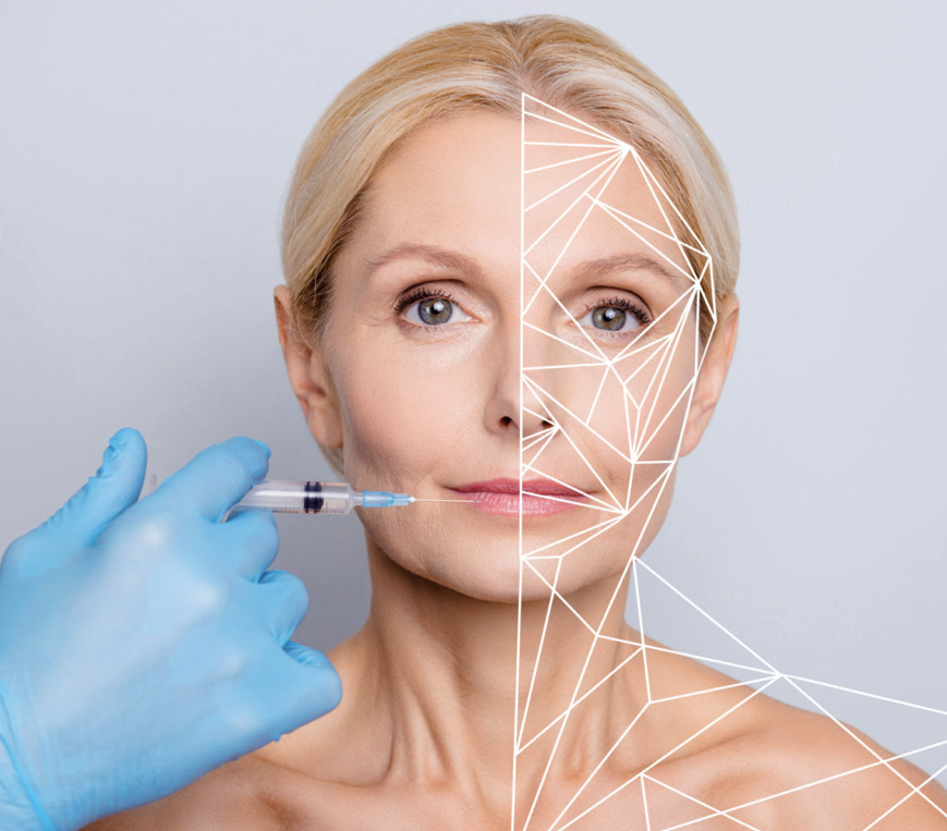 Sculptra Treatment