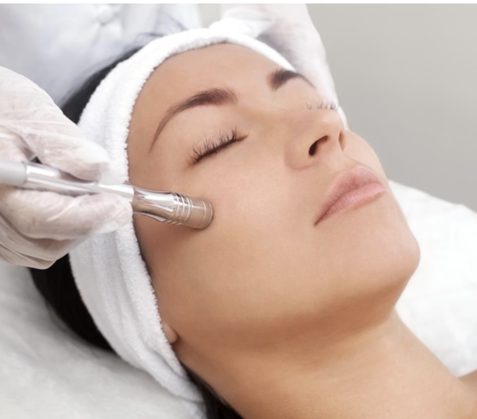Microdermabrasion