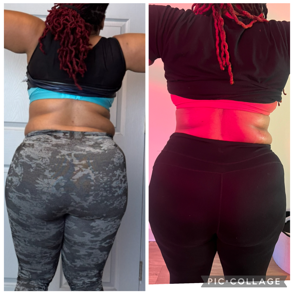 Bare Glow Kickstart at BARE AND SMOOTH ESTHETICS LLC in Lombard, IL