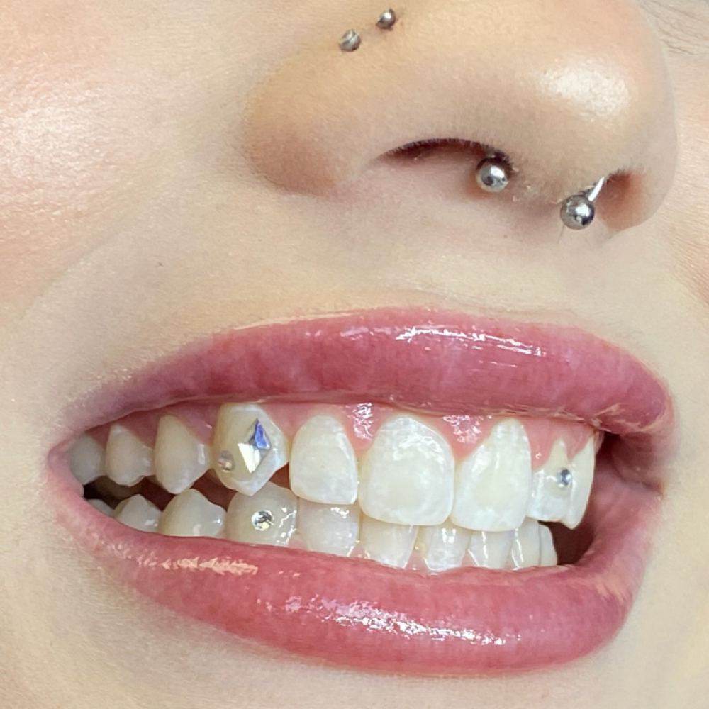 Tooth Gems
