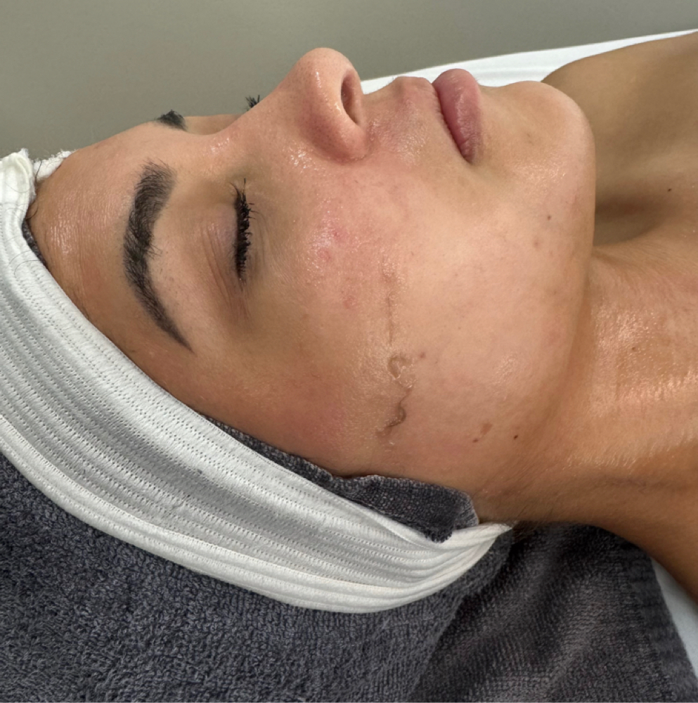 The Dermaplane Edit Facial