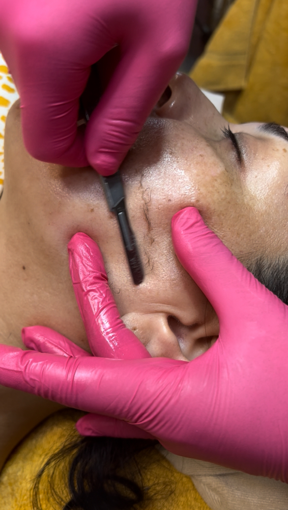 Dermaplane + Happy Peel