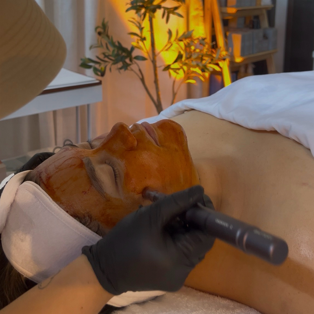 Facial Infusion- RTN Guest Only at Rooted Skin in La Mesa, CA