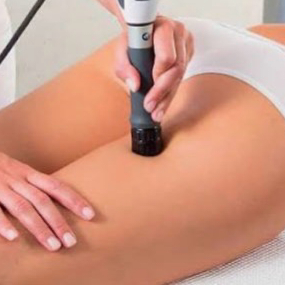 Focused Acoustic fat removal at Sculpted Body Renewal in Villa Rica, GA