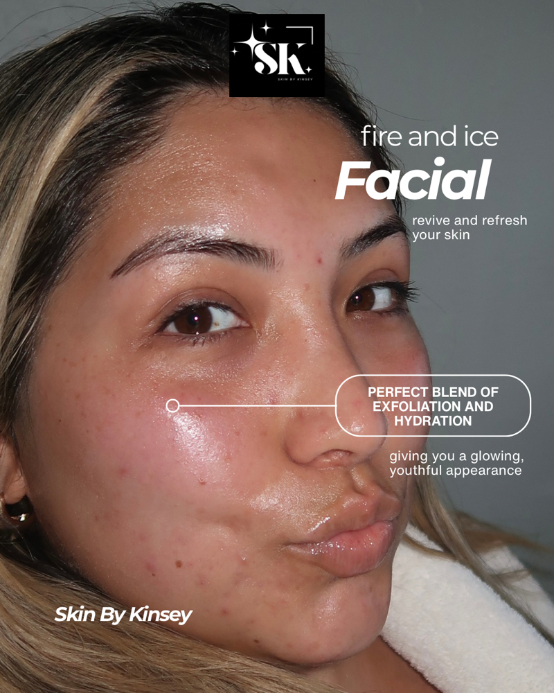 Fire & Ice Facial