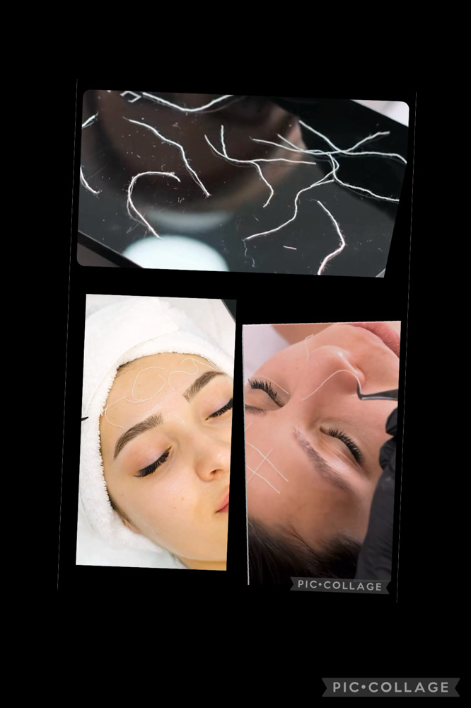 Non-Invasive Collagen Threads Facial