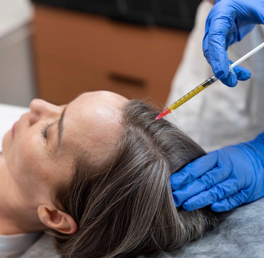 Hair Restoration at Aurora Glow Aesthetics in Spring, TX