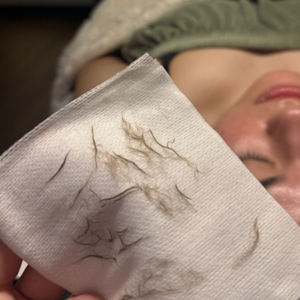 Facials - Dermaplane Facial at Blissful Skin LLC in Glendale, AZ