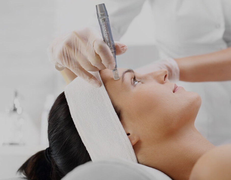 Nano Needling Add On at Skin by Design in Amarillo, TX
