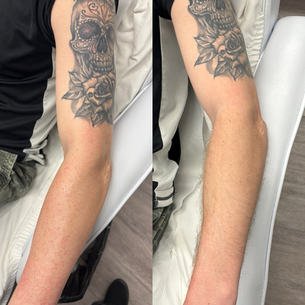 Arm Wax