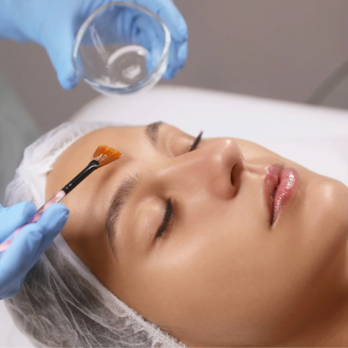 Hydrating Lactic Acid Peel at Pure Platinum Esthetics in Dublin, OH