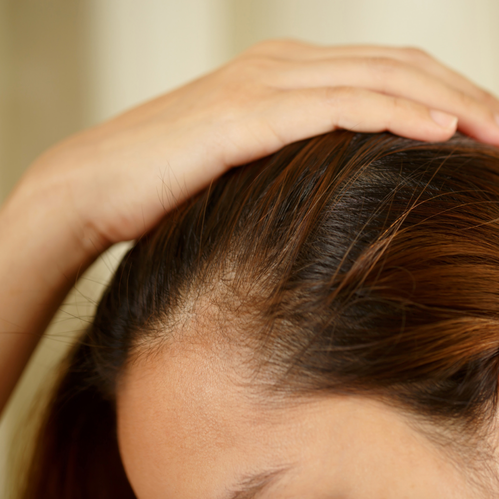 SMP Hairline/Crown Restoration