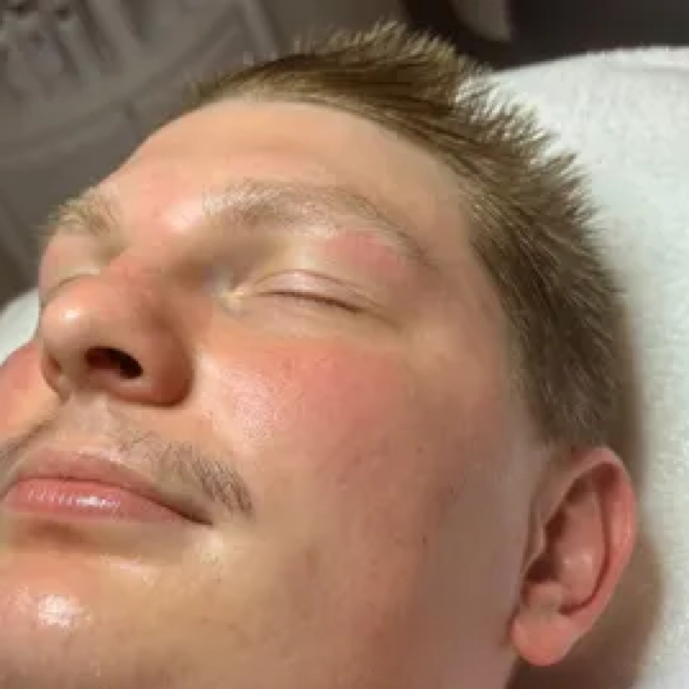 Men’s Refresh at Naturally Esthetics in Myrtle Beach, SC