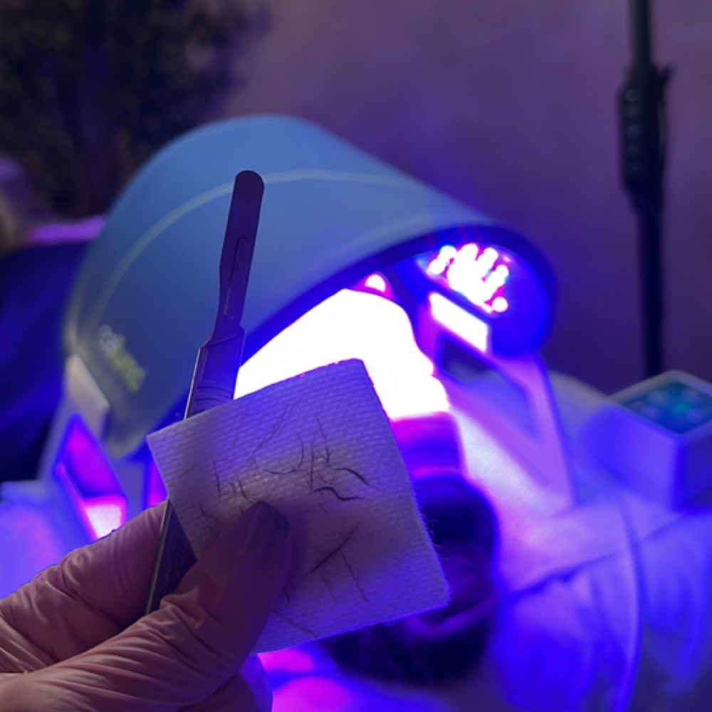 Rain Deluxe Dermaplane Facial at Rain Aesthetics in Rancho Cucamonga, CA