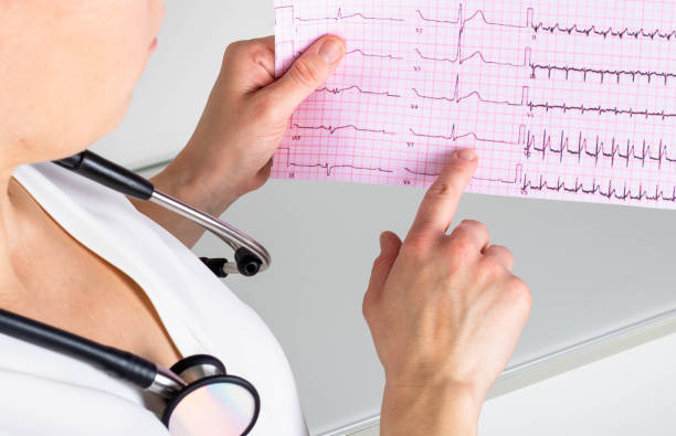 EKG