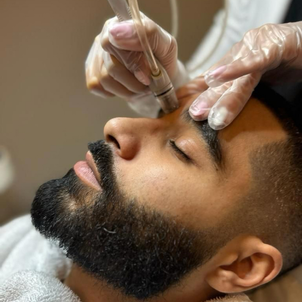 Hydro Microdermabrasion AHA at Millennium Day Spa in Inglewood, CA