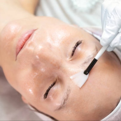 Alpha Beta Peel Facial (Circadia®) at SUSH Skin Studio And Spa in Covington, WA