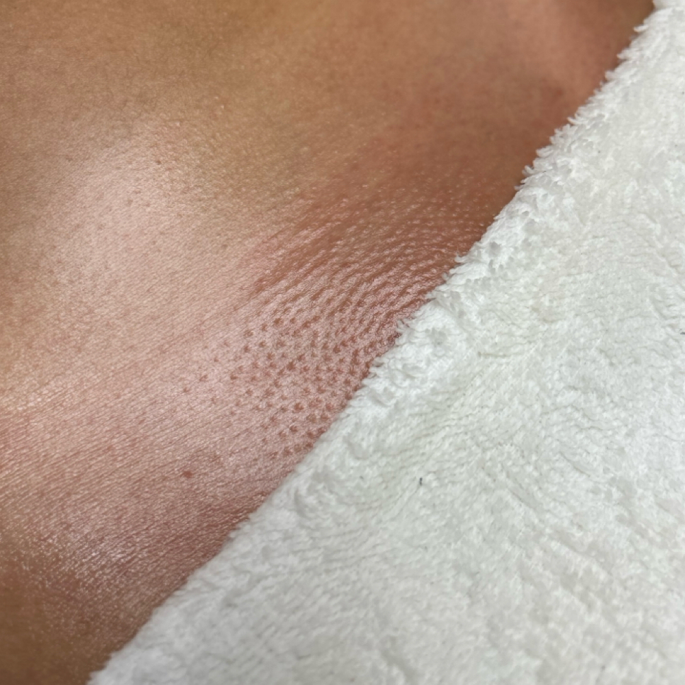 PRETTY KITTY BUNDLE at BBL ESTHETICS WAX CENTER in Victorville, CA