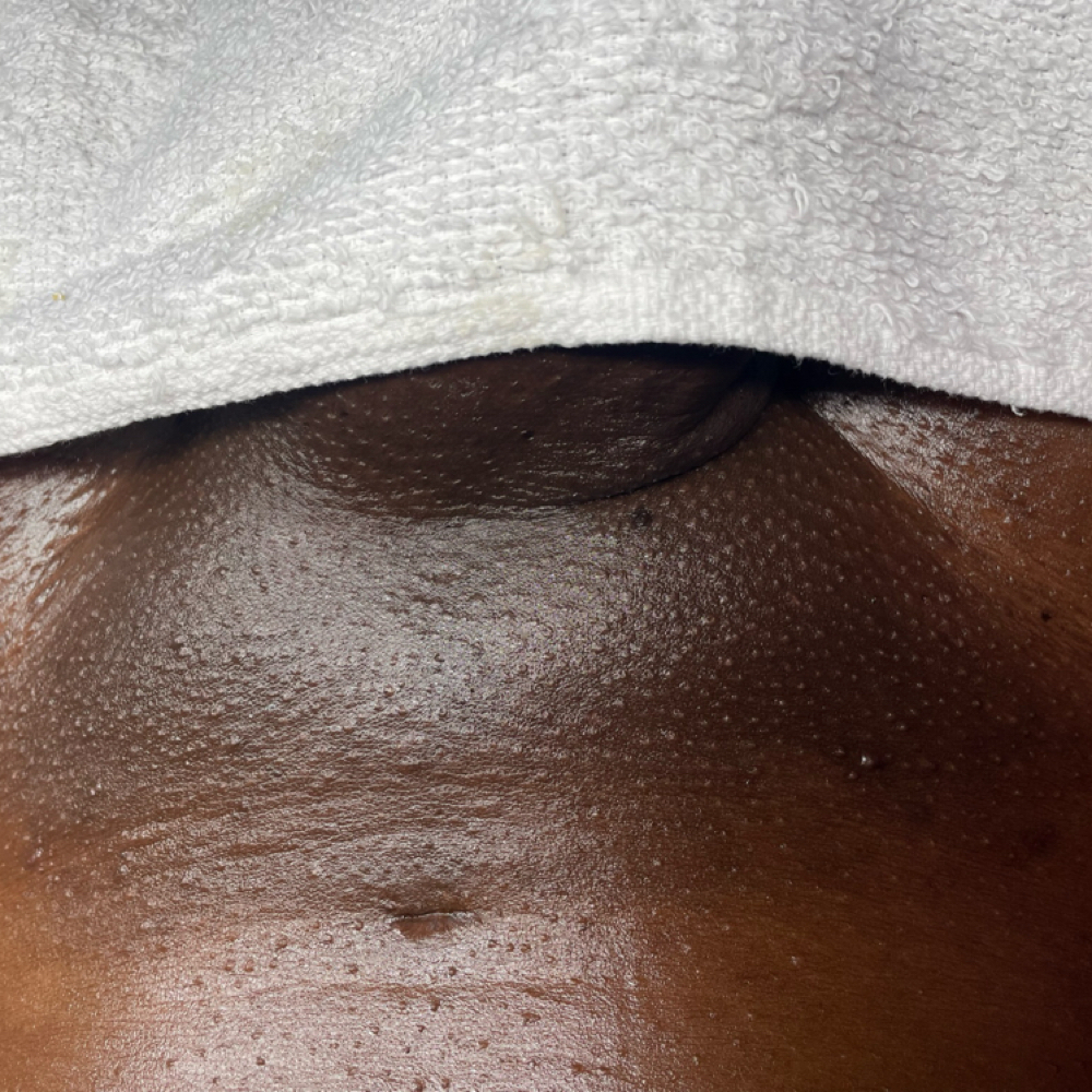 Manzilian - Bring A Friend Deal at ALL GLOWN UP SKINCARE in Temple Hills, MD