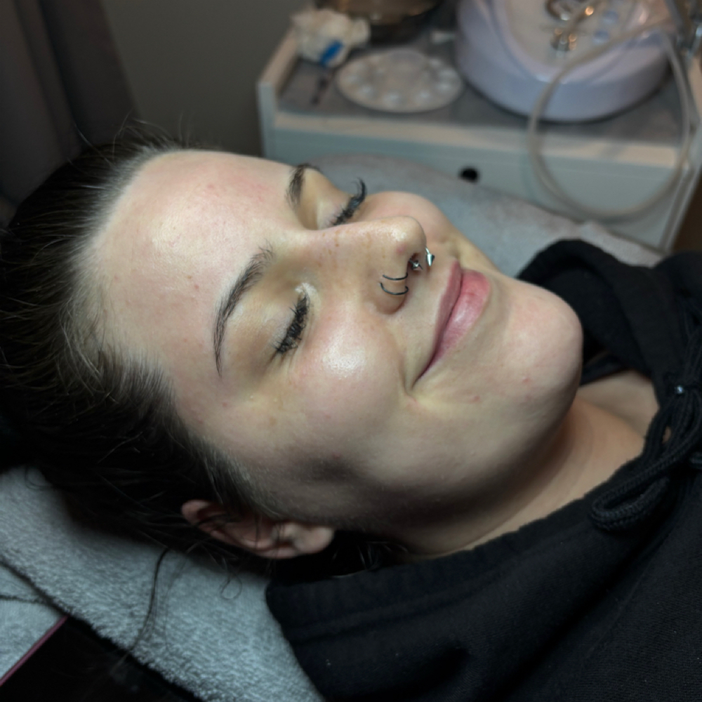 💣 Microderm Glow Renewal Facial at B Bomb Beauty Esthetics in Wichita, KS