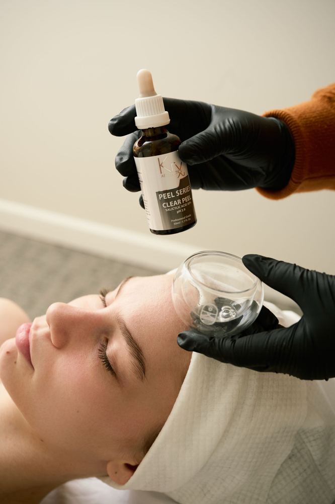 Customized K-hemical Peel Facial